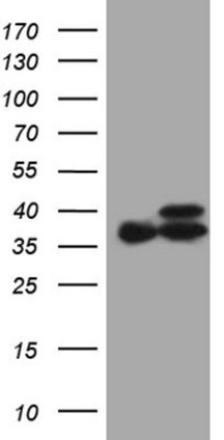 ETFA Antibody (OTI5C4), Novus Biologicals 0.1mL; Unlabeled:Antibodies,