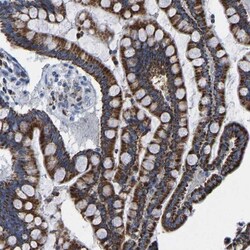 ETFA Antibody, Novus Biologicals:Antibodies:Primary Antibodies