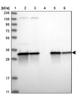 ETFA Antibody, Novus Biologicals:Antibodies:Primary Antibodies