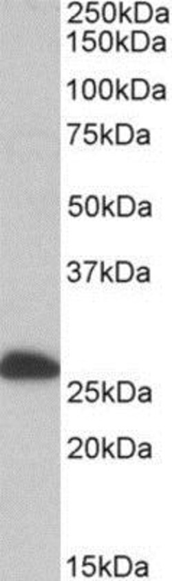 ETFB Antibody, Novus Biologicals 0.1mg; Unlabeled:Antibodies, Polyclonal