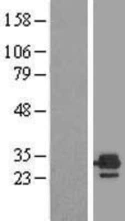 Novus Biologicals&trade;&nbsp;ETFB Overexpression Lysate