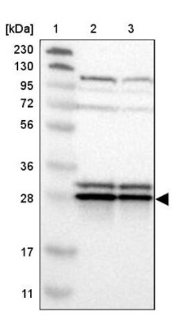 ETFB Antibody, Novus Biologicals 25 &mu;L | Buy Online | Novus Biologicals | Fisher Scientific
