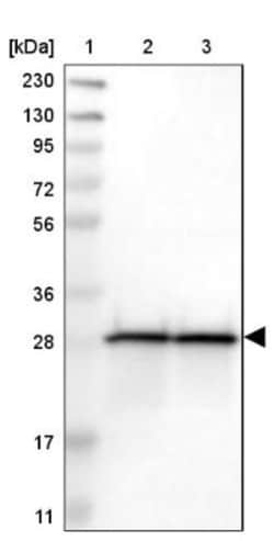 ETFB Antibody, Novus Biologicals 25 &mu;L; Unlabeled:Antibodies, Polyclonal