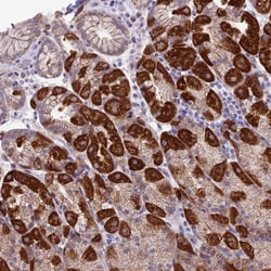 ETFDH Antibody, Novus Biologicals:Antibodies:Primary Antibodies