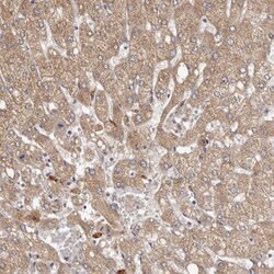 ethanolamine kinase Antibody, Novus Biologicals 0.1mL; Unlabeled:Antibodies,