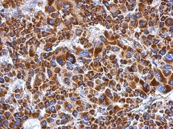 ETHE1 Antibody, Novus Biologicals 0.1mL; Unlabeled:Antibodies, Polyclonal