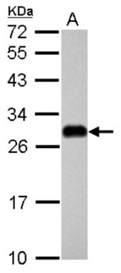 ETHE1 Antibody, Novus Biologicals 0.1mL; Unlabeled:Antibodies, Polyclonal
