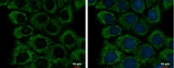 ETHE1 Antibody (1621), Novus Biologicals 0.1mL; Unlabeled:Antibodies, Monoclonal