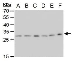 ETHE1 Antibody (1621), Novus Biologicals 0.1mL; Unlabeled:Antibodies, Monoclonal