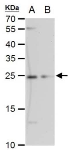 ETHE1 Antibody (1621), Novus Biologicals 0.1mL; Unlabeled:Antibodies, Monoclonal