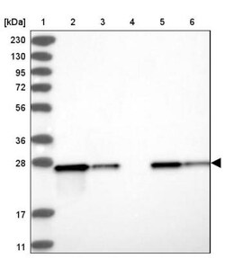 ETHE1 Antibody, Novus Biologicals 25 &mu;L | Buy Online | Novus Biologicals | Fisher Scientific