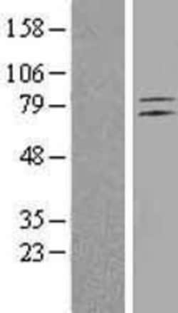 Novus Biologicals&trade;&nbsp;ELTD1/ETL Overexpression Lysate
