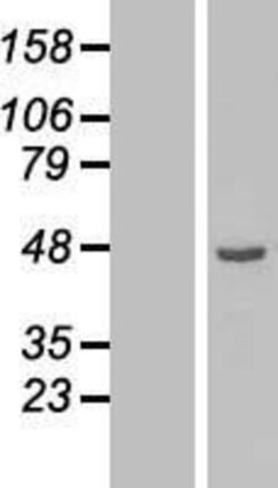 Novus Biologicals&trade;&nbsp;ETNK2 Overexpression Lysate