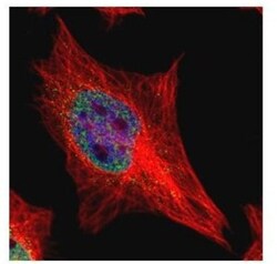 ETS1 associated protein II Antibody, Novus Biologicals 0.1mL; Unlabeled:Antibodies,