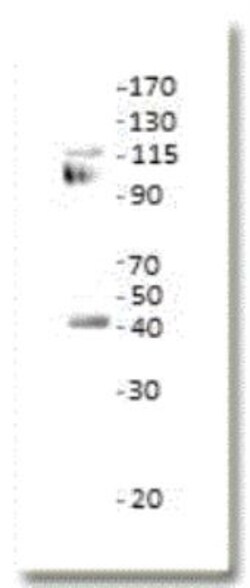 ETS1 associated protein II Antibody, Novus Biologicals:Antibodies:Primary