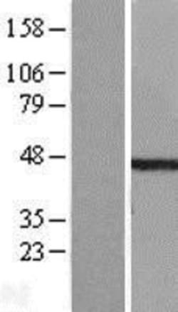 Novus Biologicals&trade;&nbsp;ETS1 associated protein II Overexpression Lysate