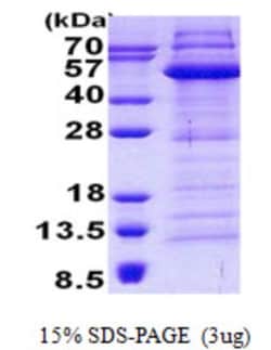 Novus Biologicals Recombinant Human ETS1 associated protein II His Protein 0.05 mg | Buy Online | Novus Biologicals&trade; | Fisher Scientific