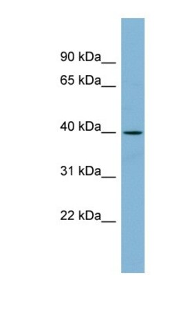 ETV3L Antibody, Novus Biologicals 100&mu;L; Unlabeled:Antibodies, Polyclonal