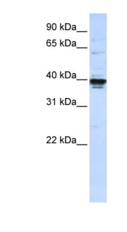ETV3L Antibody, Novus Biologicals 100 &mu;L | Buy Online | Novus Biologicals | Fisher Scientific