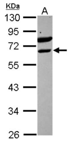 ETV6/Tel Antibody, Novus Biologicals 0.1mL; Unlabeled:Antibodies, Polyclonal