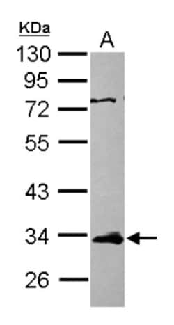 ETV7 Antibody, Novus Biologicals 0.1 mL | Buy Online | Novus Biologicals | Fisher Scientific
