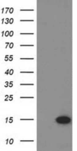 Eukaryotic translation initiation factor 1 Antibody (OTI2B9), Novus Biologicals 0.1 mL | Buy Online | Novus Biologicals | Fisher Scientific