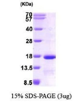 Novus Biologicals&trade;&nbsp;Recombinant Human Eukaryotic translation initiation factor 1 His Protein