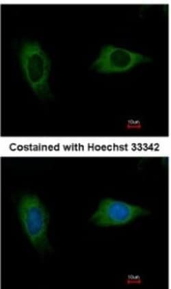 EVC2 Antibody, Novus Biologicals 0.1mg; Unlabeled:Antibodies, Polyclonal