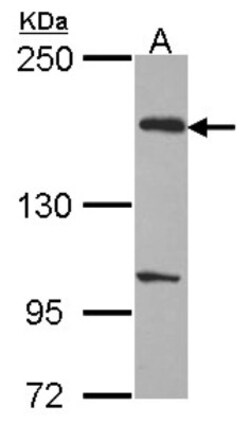 EVC2 Antibody, Novus Biologicals 0.1mg; Unlabeled:Antibodies, Polyclonal