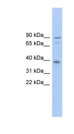 EVER2 Antibody, Novus Biologicals 100&mu;L; Unlabeled:Antibodies, Polyclonal