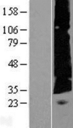 Novus Biologicals&trade;&nbsp;EVG1 Overexpression Lysate