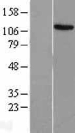 Novus Biologicals&trade;&nbsp;EVI-1 Overexpression Lysate