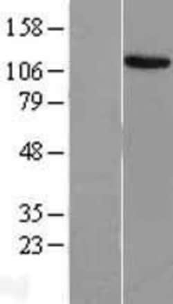 Novus Biologicals&trade;&nbsp;EVI-1 Overexpression Lysate