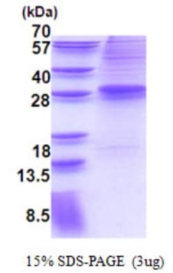 Novus Biologicals&trade;&nbsp;Recombinant Human EVI-1 His Protein
