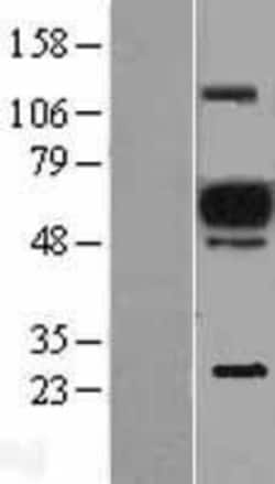 Novus Biologicals&trade;&nbsp;EVI2A Overexpression Lysate