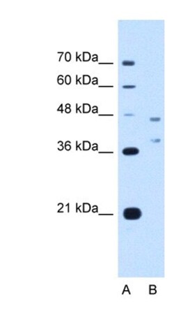 EVI2B Antibody, Novus Biologicals:Antibodies:Primary Antibodies