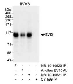 EVI5 Antibody, Novus Biologicals 0.1mg; Unlabeled:Antibodies, Polyclonal