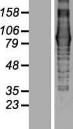 Novus Biologicals&trade;&nbsp;EVI5L Overexpression Lysate