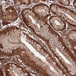 EVI5L Antibody, Novus Biologicals:Antibodies:Primary Antibodies