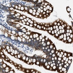 EVORF Antibody, Novus Biologicals 0.1mL; Unlabeled:Antibodies, Polyclonal