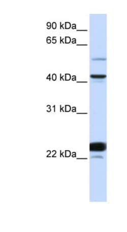 Evx1 Antibody, Novus Biologicals 100 &mu;L | Buy Online | Novus Biologicals | Fisher Scientific