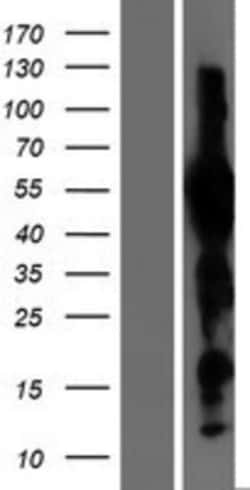 Novus Biologicals&trade;&nbsp;Evx1 Overexpression Lysate