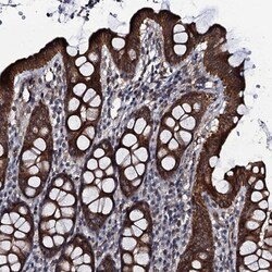 EVX2 Antibody, Novus Biologicals 25 &mu;L; Unlabeled:Antibodies, Polyclonal