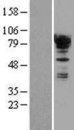 Novus Biologicals&trade;&nbsp;EWSR1 Overexpression Lysate