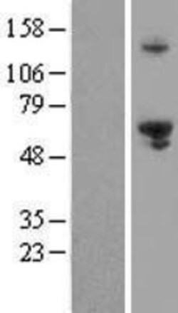 Novus Biologicals&trade;&nbsp;EXD1 Overexpression Lysate