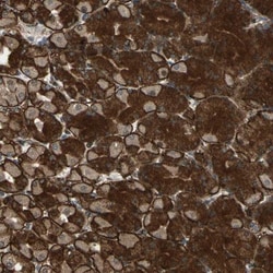 EXD2 Antibody, Novus Biologicals:Antibodies:Primary Antibodies