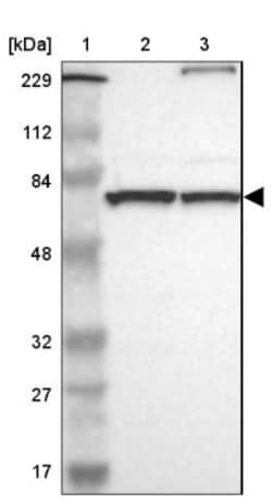 EXD2 Antibody, Novus Biologicals:Antibodies:Primary Antibodies