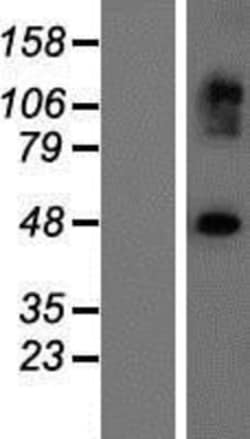 Novus Biologicals™ EXOC3L2 Overexpression Lysate