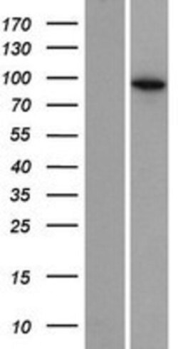 Novus Biologicals&trade;&nbsp;EXOC6B Overexpression Lysate