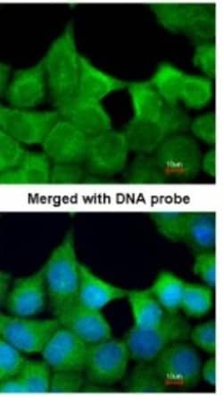EXOC7 Antibody, Novus Biologicals 0.1mg; Unlabeled:Antibodies, Polyclonal